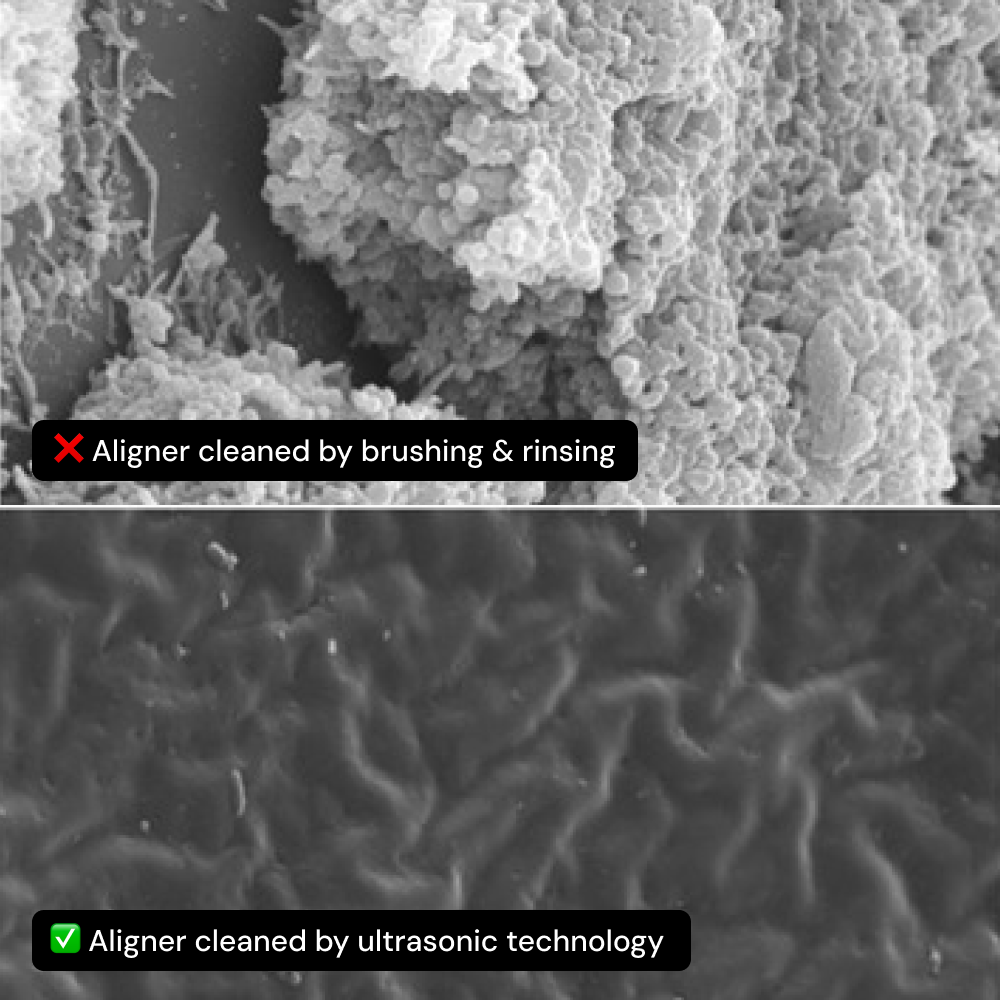 Microscope views of a brushed aligner and an ultrasonically cleaned aligner
