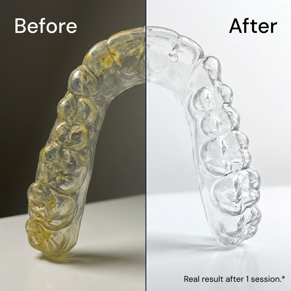 An aligner before and after a PureDental clean