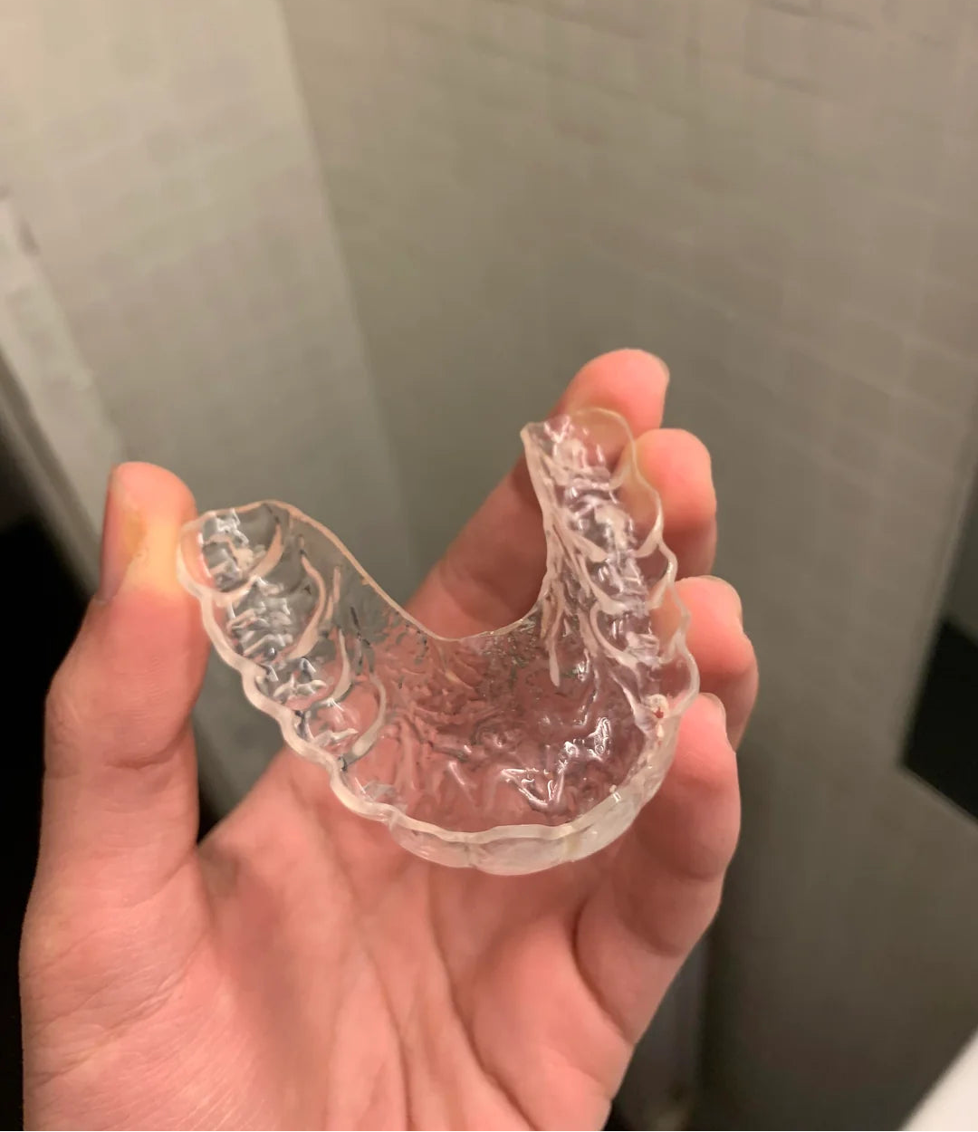 The same aligner, clear, after a deep clean