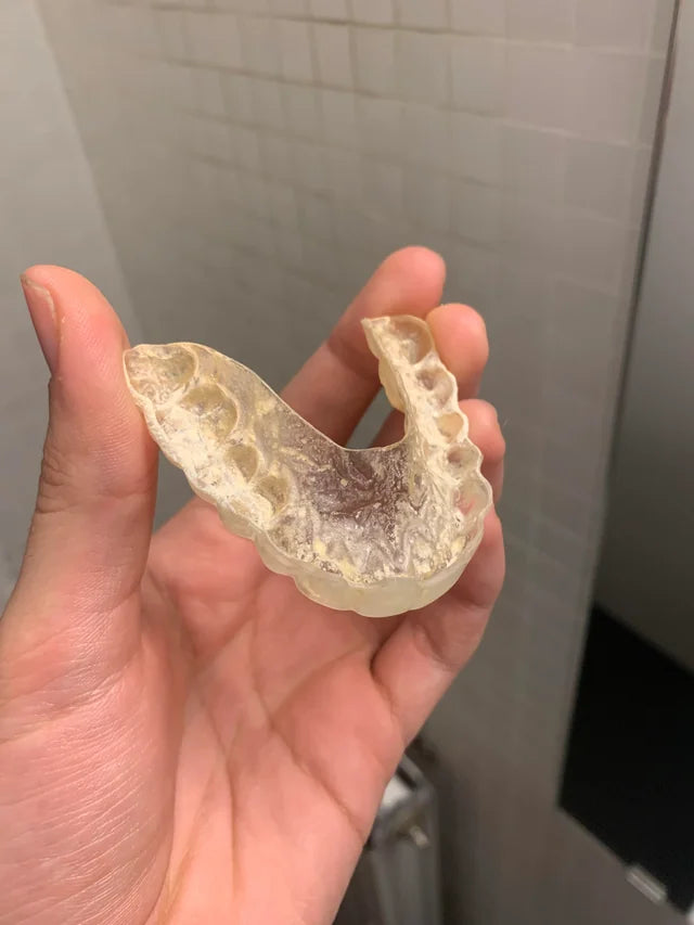 A yellowed aligner before a deep clean