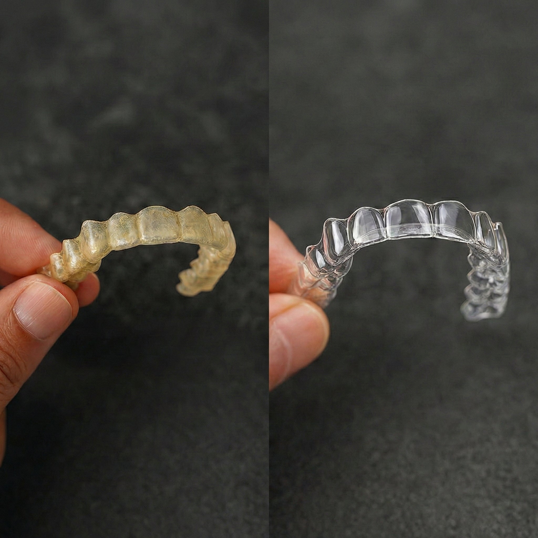 A yellowed aligner beside a clean, clear aligner