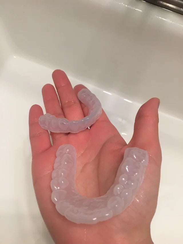 Clean retainers in a palm
